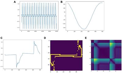 A Wasserstein-based distributionally robust neural network for non-intrusive load monitoring